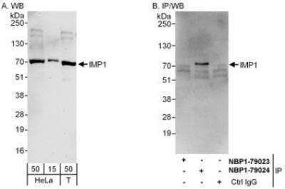 Western Blot: IGF2BP1 Antibody [NBP1-79023]