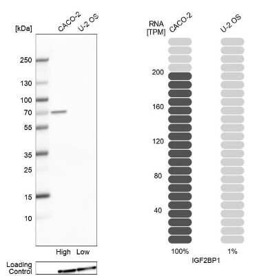 Western Blot: IGF2BP1 Antibody [NBP1-83108]