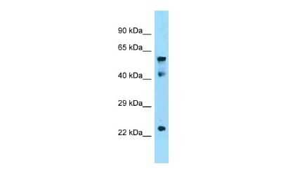 Western Blot: IGF2BP1 Antibody [NBP2-36473]