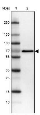 Western Blot: IGF2BP1 Antibody [NBP2-38956]
