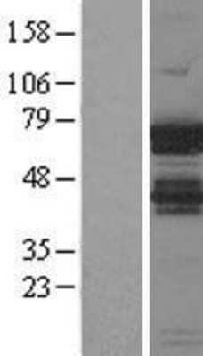 Western Blot: IGF2BP1 Overexpression Lysate [NBL1-11870]