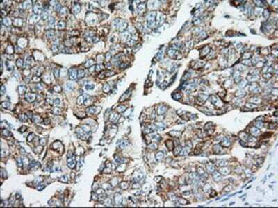 Immunohistochemistry-Paraffin: IMP2/IGF2BP2 Antibody (OTI3F9) [NBP2-02627]