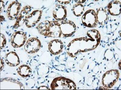 Immunohistochemistry-Paraffin: IMP2/IGF2BP2 Antibody (OTI3F9) [NBP2-02627]
