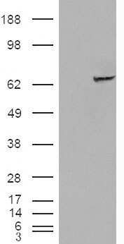 Western Blot: IMP2/IGF2BP2 Antibody [NB100-93408]