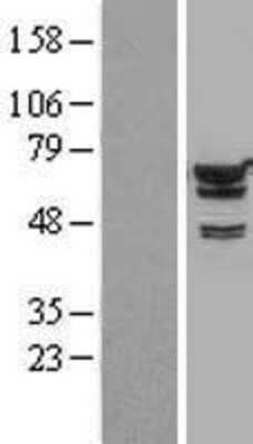 Western Blot: IMP2/IGF2BP2 Overexpression Lysate [NBL1-11871]