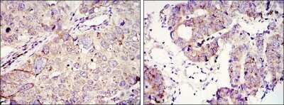 Immunohistochemistry-Paraffin: IGF2BP3 Antibody (8F11) - BSA Free [NBP1-51674]