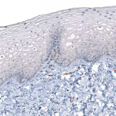 Immunohistochemistry-Paraffin: IGF2BP3 Antibody [NBP1-84339]