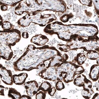 Immunohistochemistry-Paraffin: IGF2BP3 Antibody [NBP1-84339]