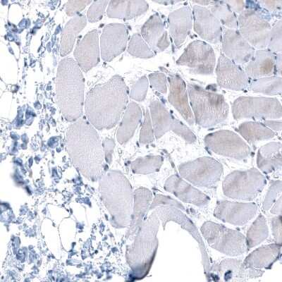 Immunohistochemistry-Paraffin: IGF2BP3 Antibody [NBP1-84339]