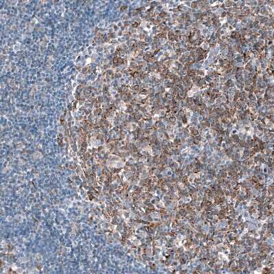 Immunohistochemistry-Paraffin: IGF2BP3 Antibody [NBP1-84339]