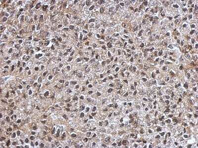 Immunohistochemistry-Paraffin: IGF2BP3 Antibody [NBP2-16930]