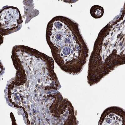 Immunohistochemistry-Paraffin: IGF2BP3 Antibody [NBP3-17037]