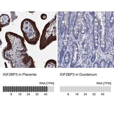 Immunohistochemistry-Paraffin: IGF2BP3 Antibody [NBP3-17037]