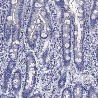 Immunohistochemistry-Paraffin: IGF2BP3 Antibody [NBP3-17037]