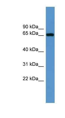 Western Blot: IGF2BP3 Antibody [NBP1-68981]