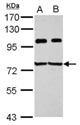 Western Blot: IGF2BP3 Antibody [NBP2-16930]