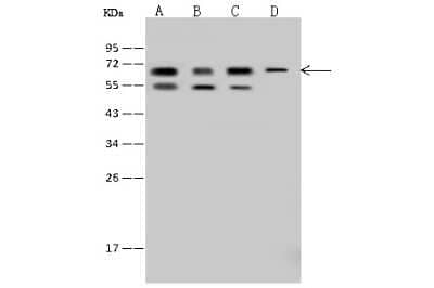 Western Blot: IGF2BP3 Antibody [NBP2-97506]