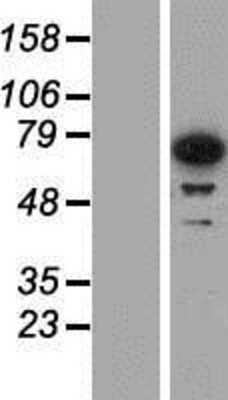 Western Blot: IGF2BP3 Overexpression Lysate [NBP2-07606]