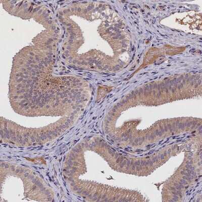 Immunohistochemistry-Paraffin: IGFALS/ALS Antibody [NBP1-89117]