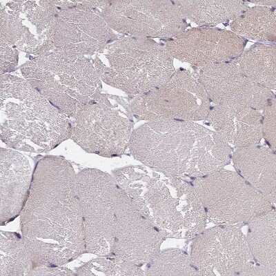 Immunohistochemistry-Paraffin: IGFALS/ALS Antibody [NBP1-89117]