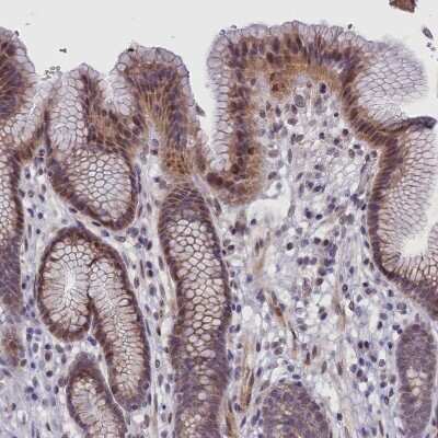 Immunohistochemistry-Paraffin: IGFALS/ALS Antibody [NBP1-89117]