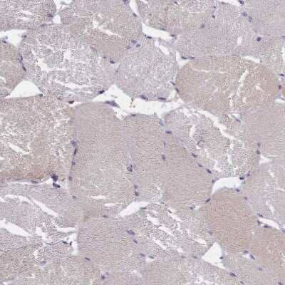 Immunohistochemistry-Paraffin: IGFALS/ALS Antibody [NBP1-89118]