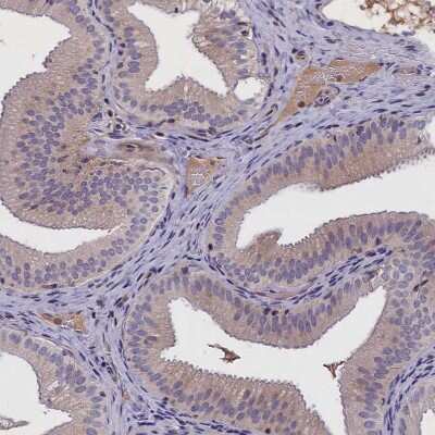 Immunohistochemistry-Paraffin: IGFALS/ALS Antibody [NBP1-89118]