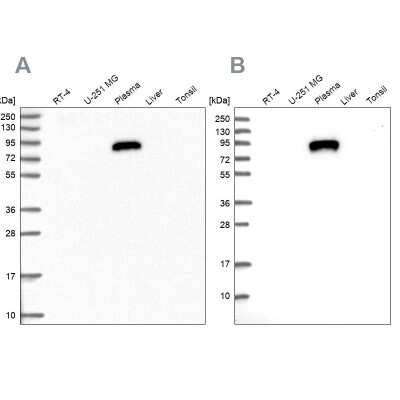 Western Blot: IGFALS/ALS Antibody [NBP1-89117]