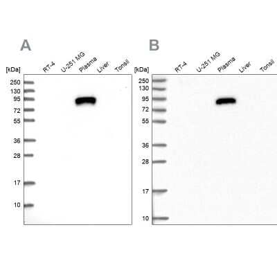 Western Blot: IGFALS/ALS Antibody [NBP1-89118]