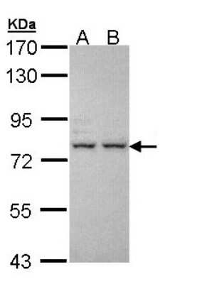 Western Blot: IGFALS/ALS Antibody [NBP1-32874]