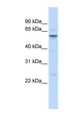 Western Blot: IGFALS/ALS Antibody [NBP1-59141]