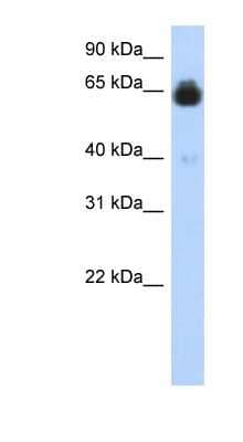 Western Blot: IGFALS/ALS Antibody [NBP1-59164]