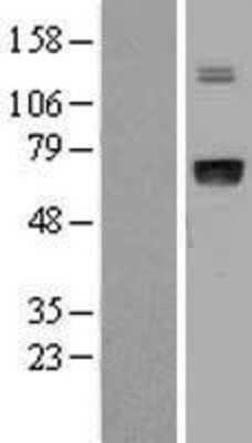 Western Blot: IGFALS/ALS Overexpression Lysate [NBL1-11872]