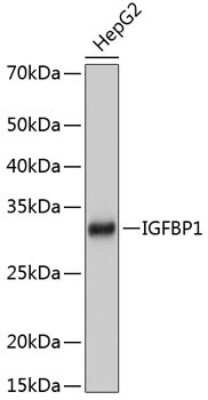 Western Blot: IGFBP-1 Antibody (2A0B5) [NBP3-15425]