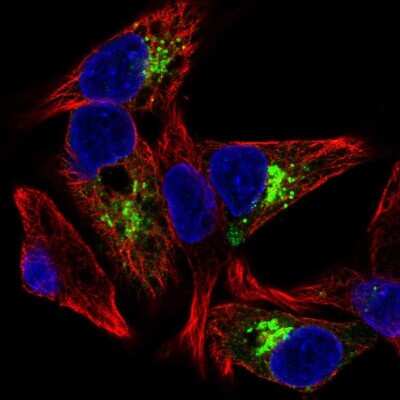 Immunocytochemistry/ Immunofluorescence: IGFBP-1 Antibody [NBP2-33475]
