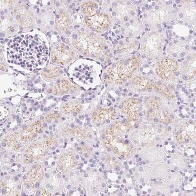 Immunohistochemistry-Paraffin: IGFBP-1 Antibody [NBP2-33475]