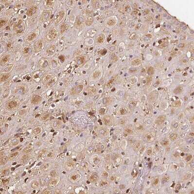 Immunohistochemistry-Paraffin: IGFBP-1 Antibody [NBP2-33475]