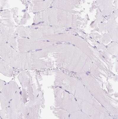 Immunohistochemistry-Paraffin: IGFBP-1 Antibody [NBP2-33475]