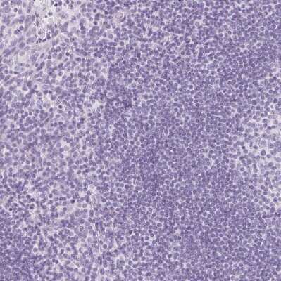 Immunohistochemistry-Paraffin: IGFBP-1 Antibody [NBP2-33475]