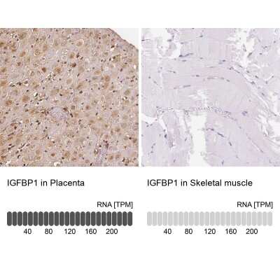 Immunohistochemistry-Paraffin: IGFBP-1 Antibody [NBP2-33475]