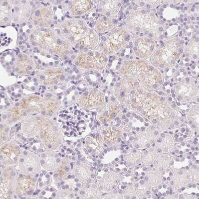 Immunohistochemistry-Paraffin: IGFBP-1 Antibody [NBP2-33599]