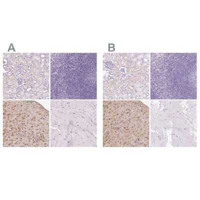 Immunohistochemistry-Paraffin: IGFBP-1 Antibody [NBP2-33599]