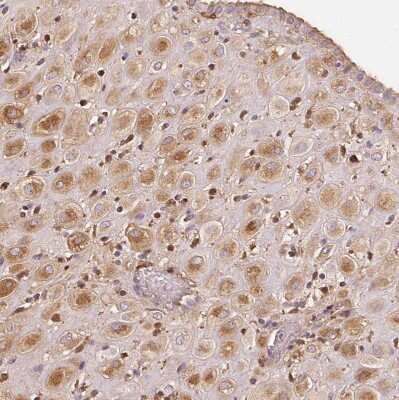 Immunohistochemistry-Paraffin: IGFBP-1 Antibody [NBP2-33599]