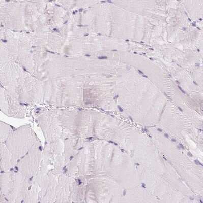 Immunohistochemistry-Paraffin: IGFBP-1 Antibody [NBP2-33599]