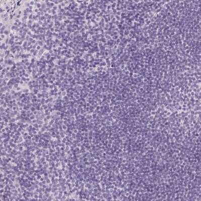Immunohistochemistry-Paraffin: IGFBP-1 Antibody [NBP2-33599]