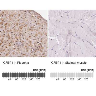 Immunohistochemistry-Paraffin: IGFBP-1 Antibody [NBP2-33599]