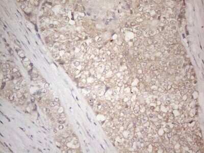 Immunohistochemistry: IGFBP-1 Antibody (OTI6C7) - Azide and BSA Free [NBP2-71011]