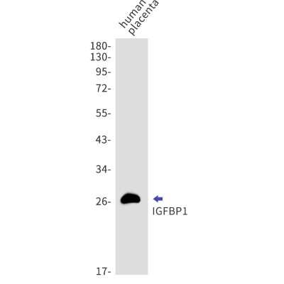 Western Blot: IGFBP-1 Antibody (S06-6J8) [NBP3-15046]