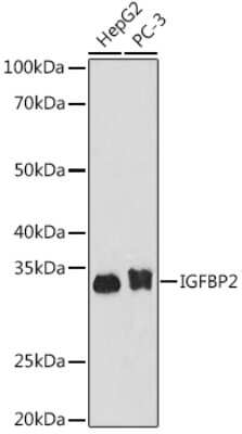 Western Blot: IGFBP-2 Antibody (4B2G6) [NBP3-16733]