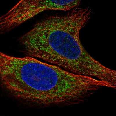 Immunocytochemistry/ Immunofluorescence: IGFBP-2 Antibody [NBP2-57978]